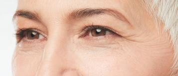 Erfahren Sie mehr über die Entfernung von Augenringen und Tränenfurchen